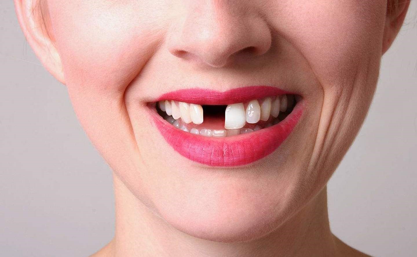 六腔是什么牙疼，真的是因为上火吗？这六大口腔误区,你中招了几个_https://www.jmylbn.com_新闻资讯_第2张